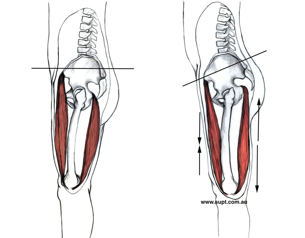 Hamstrings-Lower-Crossed