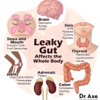 leaky-gut-bone-broth