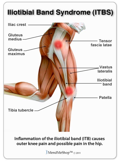 How To Foam Roll Your IT Band, #site_title