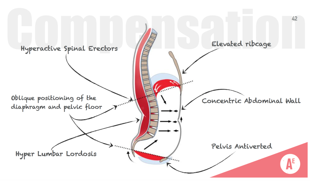 Extension Compression Stabilizing Strategy Char