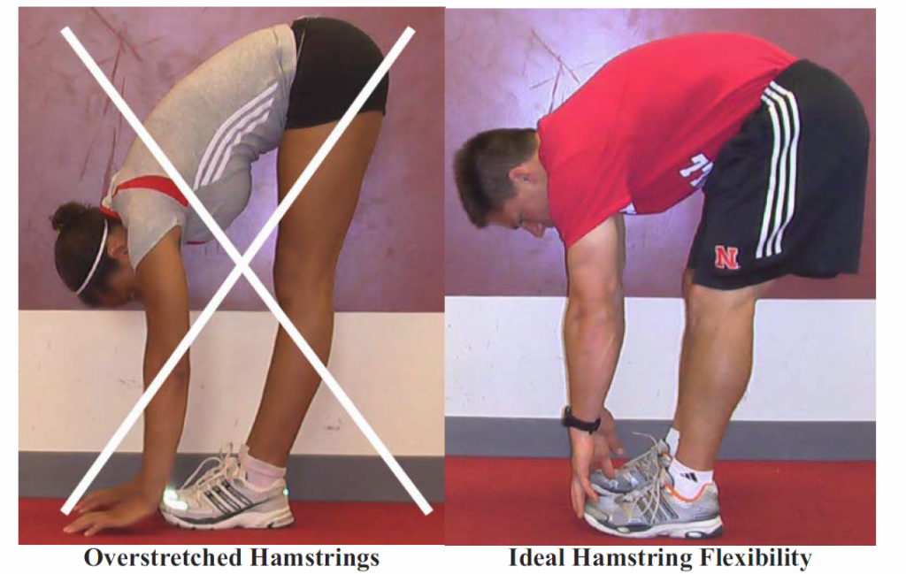 Overstretched Hamstrings