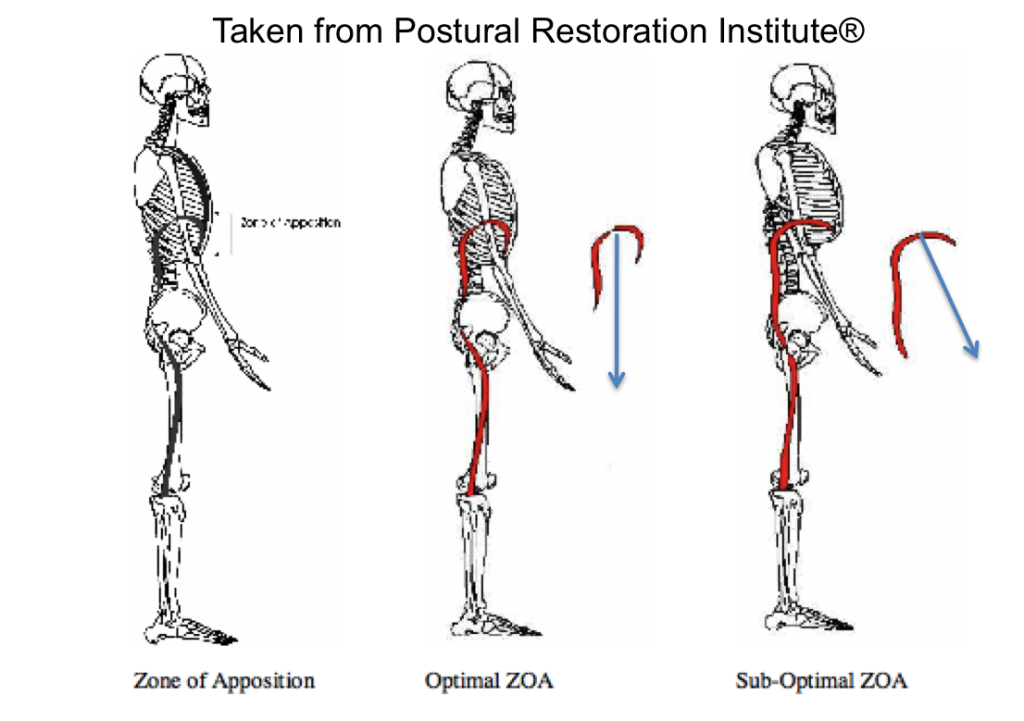 PRI Zone of Apposition